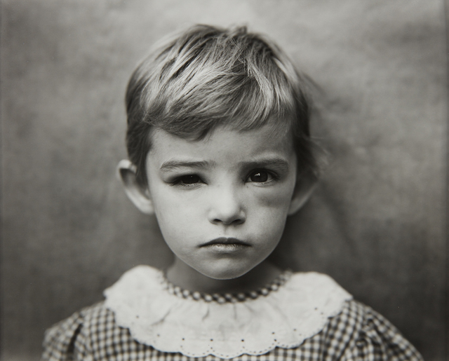 Sally Mann, ‘Damaged Child’, 1984, Phillips