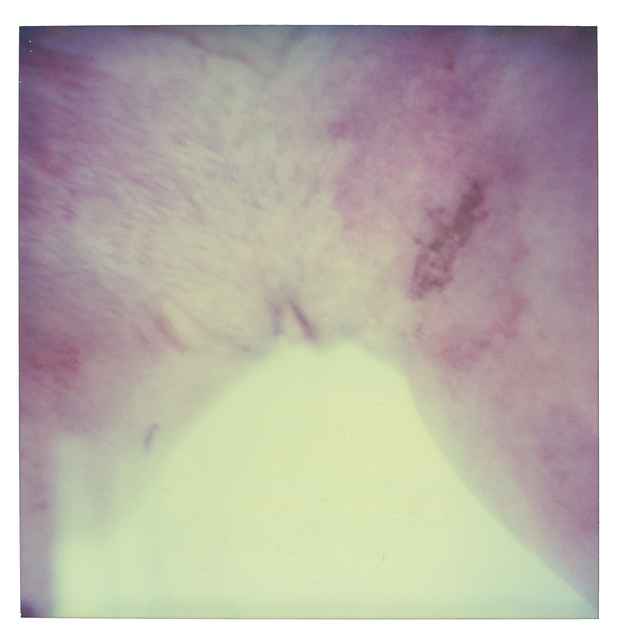 Stefanie Schneider, ‘Burned - Self Portrait’, 1999, Photography, Print on Velvet Watercolor, 310gsm, No OBAs, Bright White, Acid Free, not mounted, Instantdreams