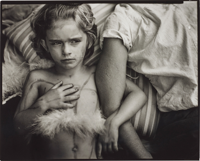 Sally Mann, ‘Jessie Bites’, 1985, Phillips
