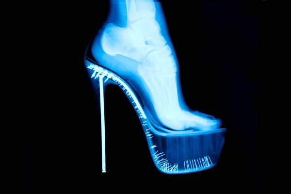 Tyler Shields, ‘X-Ray High Heel’, 2012, Isabella Garrucho Fine Art