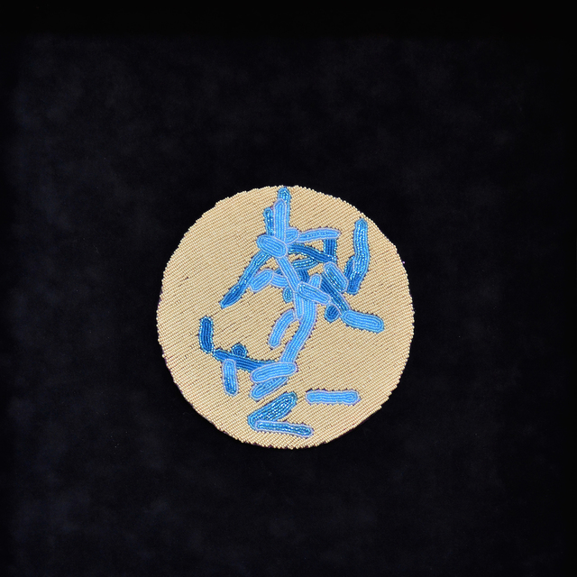 Ruth Cuthand, ‘Shigellosis’, 2016, dc3 Art Projects