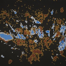 Linda Syddick Napaltjarri