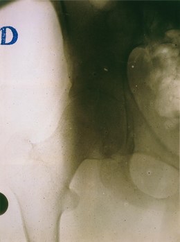 Julian Schnabel, ‘Untitled (Christ's Last Day) I’, 2007, Mixed Media, Ink on polyester, Gagosian