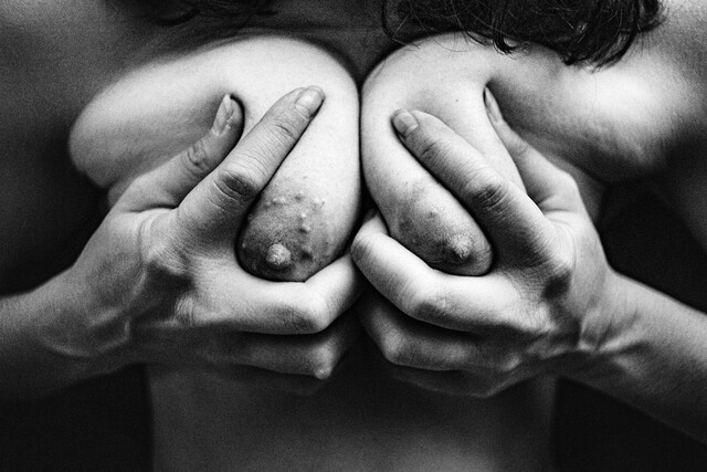 Zigzags in the Chest Cavity