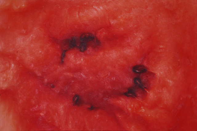 LIYONG LIU, ‘Watermelon no.3’, 2009, Aki Gallery