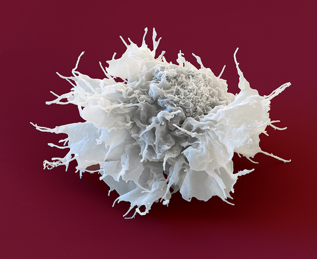 Nicole Ottawa & Oliver Meckes, ‘Under Your Skin, Dendritic cell, Scanning-electron- microscope 7000:1’, 2018, Photography, Archival pigment print, °CLAIRbyKahn Galerie
