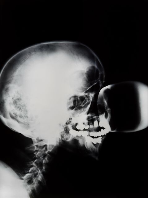 Isa Genzken, ‘X-Ray’, Photography, Stedelijk Museum Amsterdam