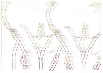 Andy Warhol - Torso (Double) (see F. & S. IIIA.35)