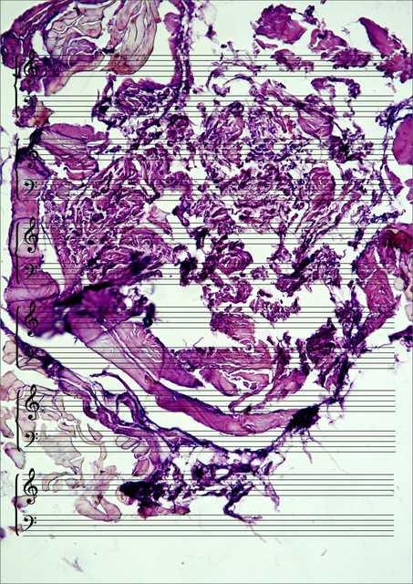 Meat Music