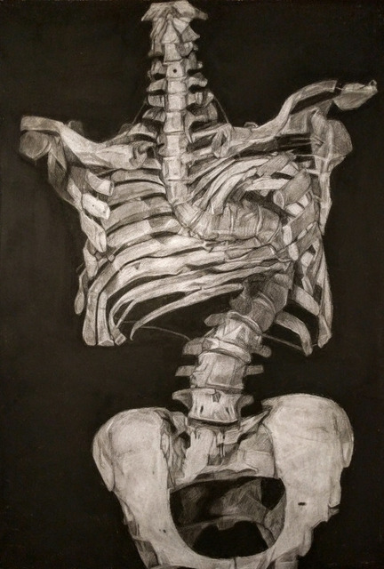 Kelly Blevins, ‘Scoliosis’, 2016, Drawing, Collage or other Work on Paper, Graphic and Charcoal on Paper (Framed), Art of Treason