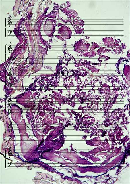 Meat Music
