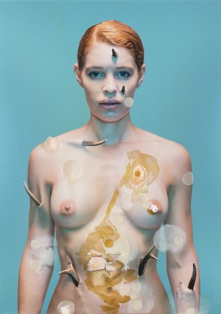Doble & Strong, ‘Lupus Vulgaris: Cornu Cutaneum Study #2’, 2015, Nanda\Hobbs
