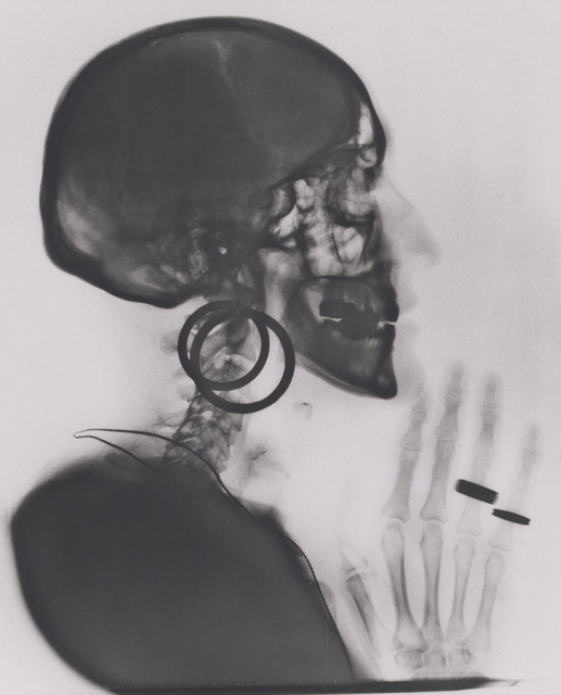 Meret Oppenheim, ‘X-ray of My Skull’, 1964; printed 1981, San Francisco Museum of Modern Art (SFMOMA)